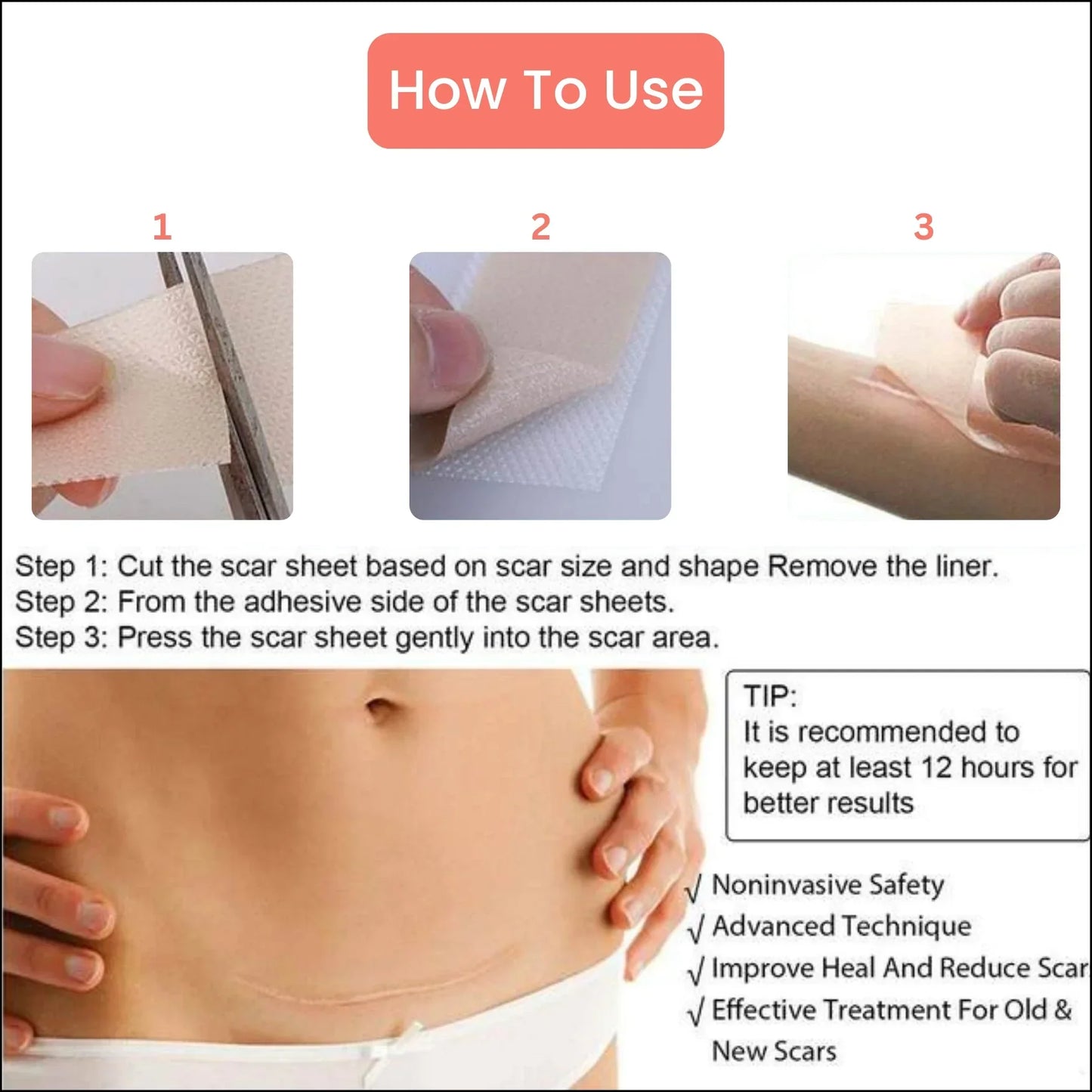 Silicone Scar Tape – For Scars from Surgery, Acne, Burns & More