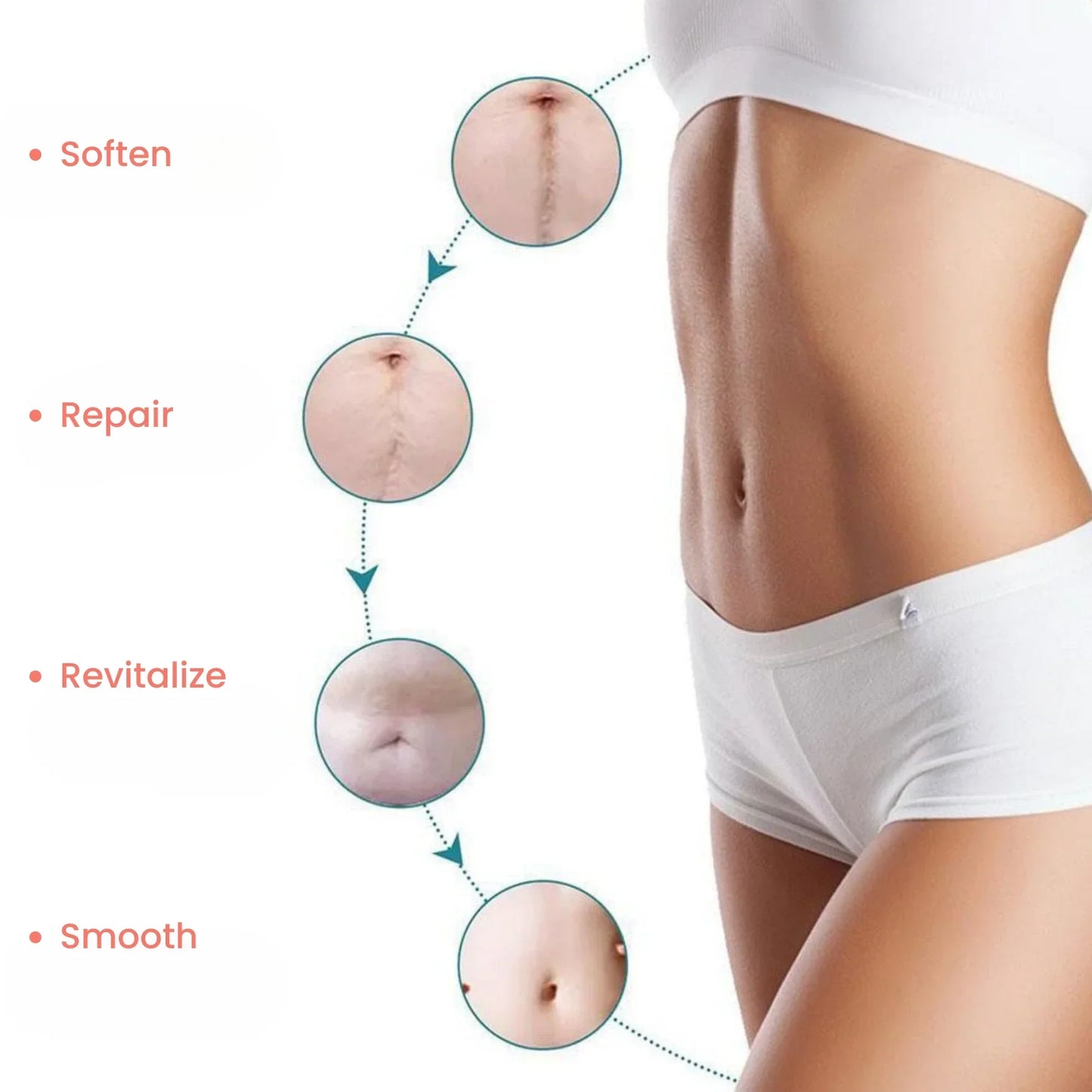 Silicone Scar Tape – For Scars from Surgery, Acne, Burns & More