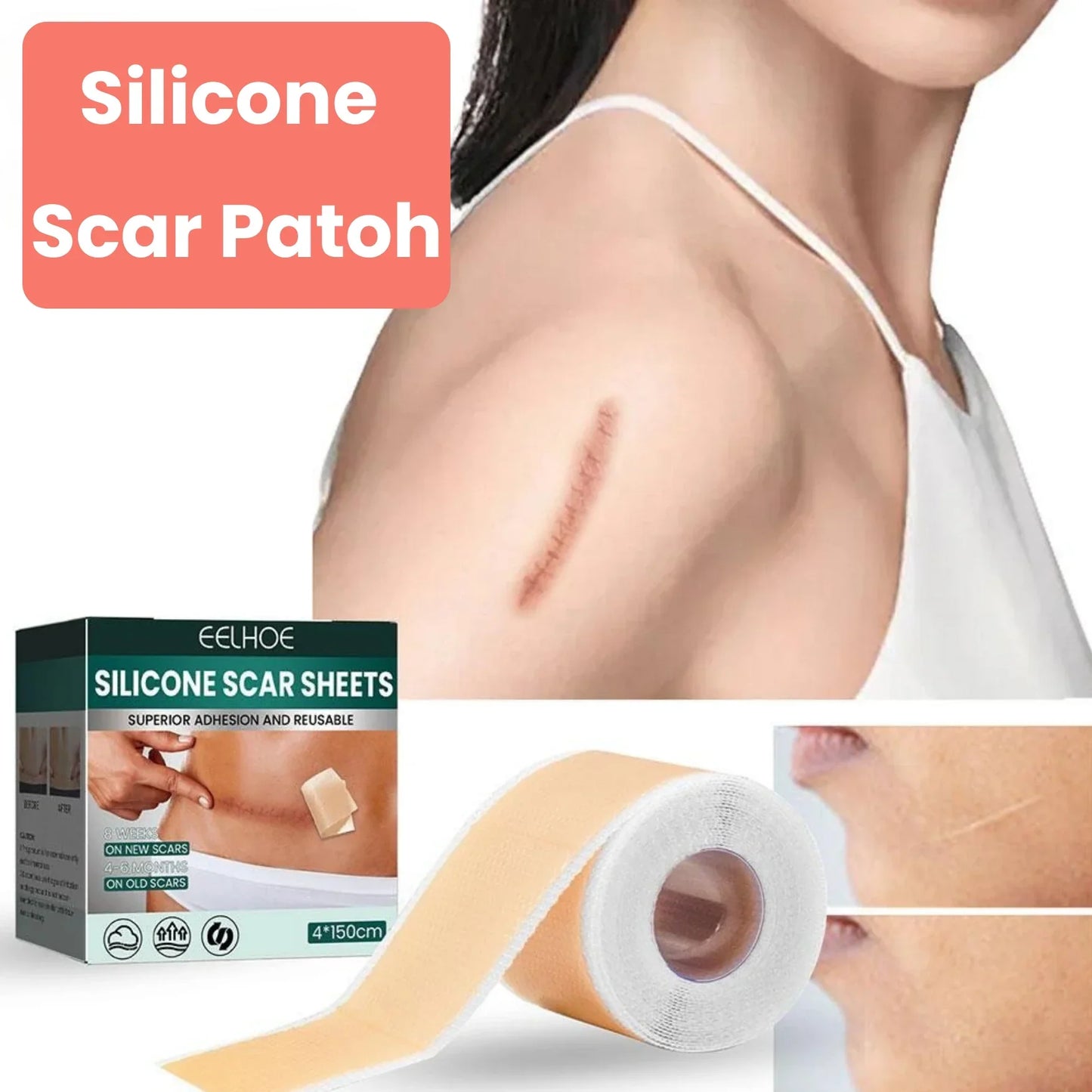 Silicone Scar Tape – For Scars from Surgery, Acne, Burns & More