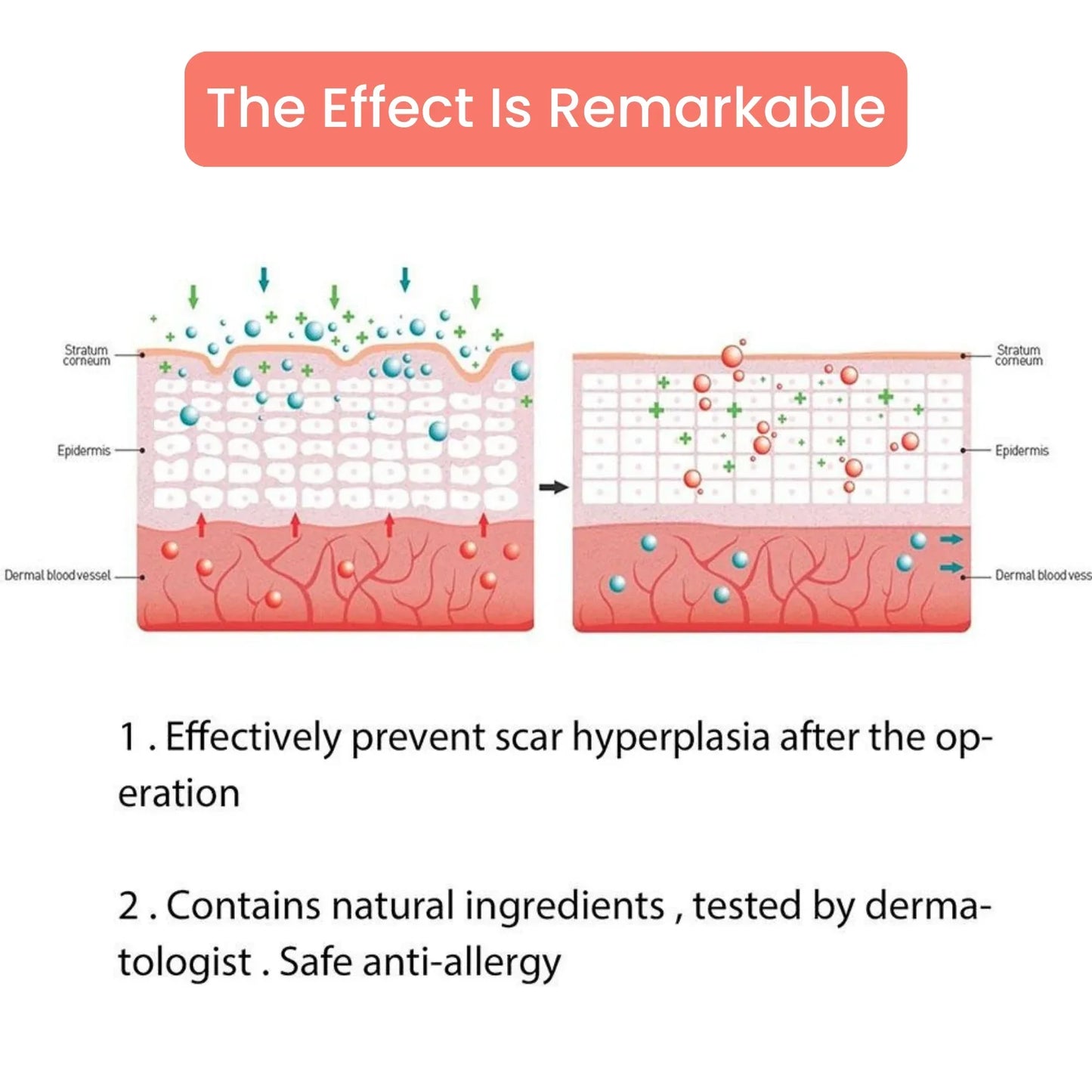 Silicone Scar Tape – For Scars from Surgery, Acne, Burns & More